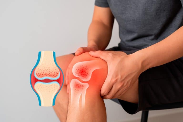 Edema óseo